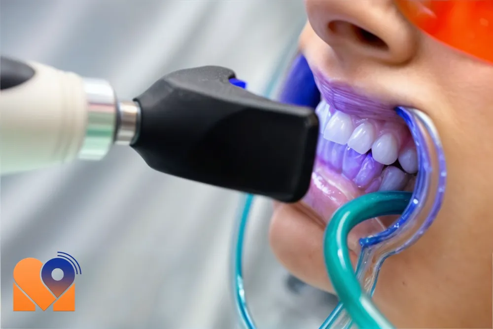 بلیچینگ دندان چیست؟