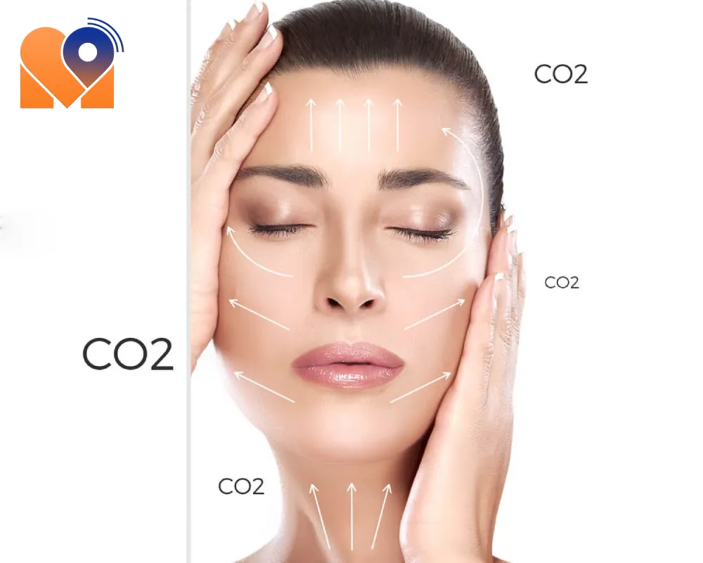 بهترین دکتر کربوکسی تراپی صورت