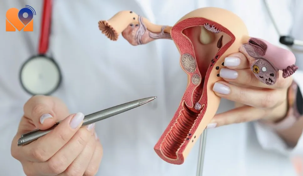 Cervical Cancer