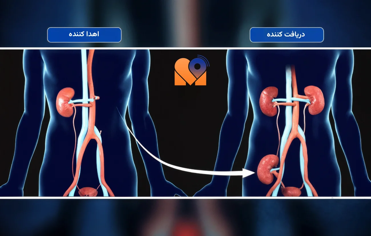 بهترین دکتر پیوند کلیه