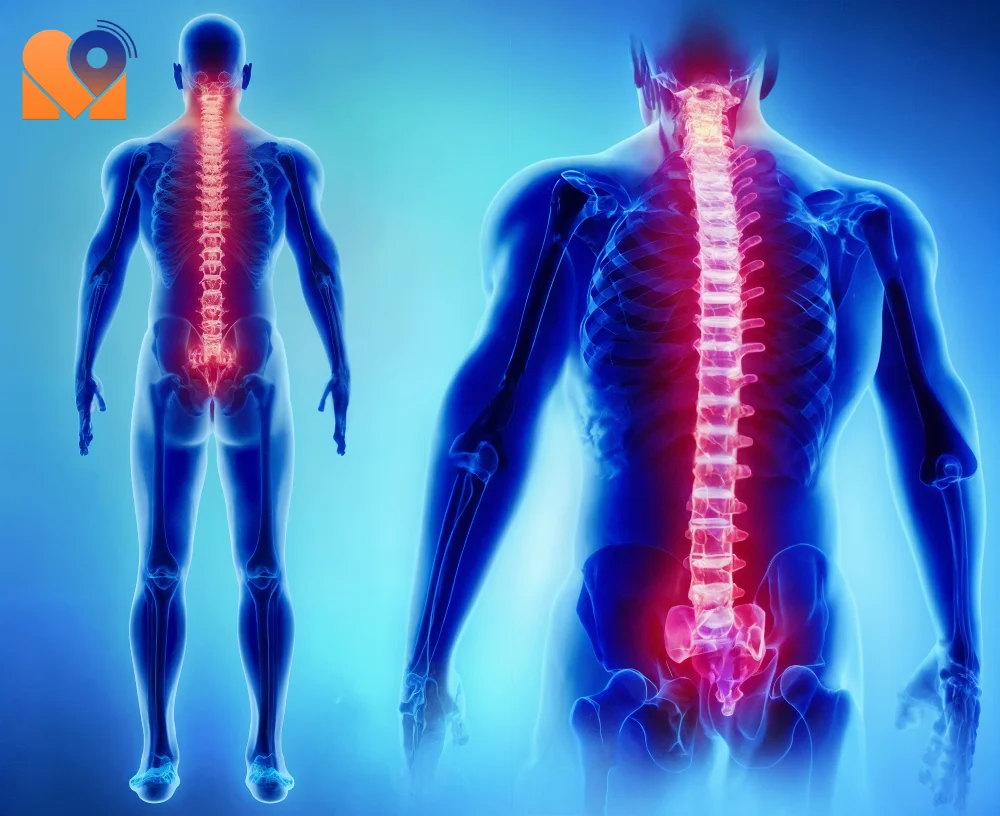 بهترین دکتر جراحی نخاع