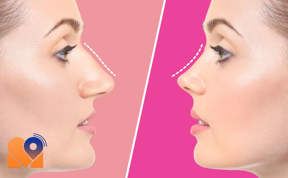 رزرو نوبت آنلاین از بهترین متخصص جراحی بینی فانتزی