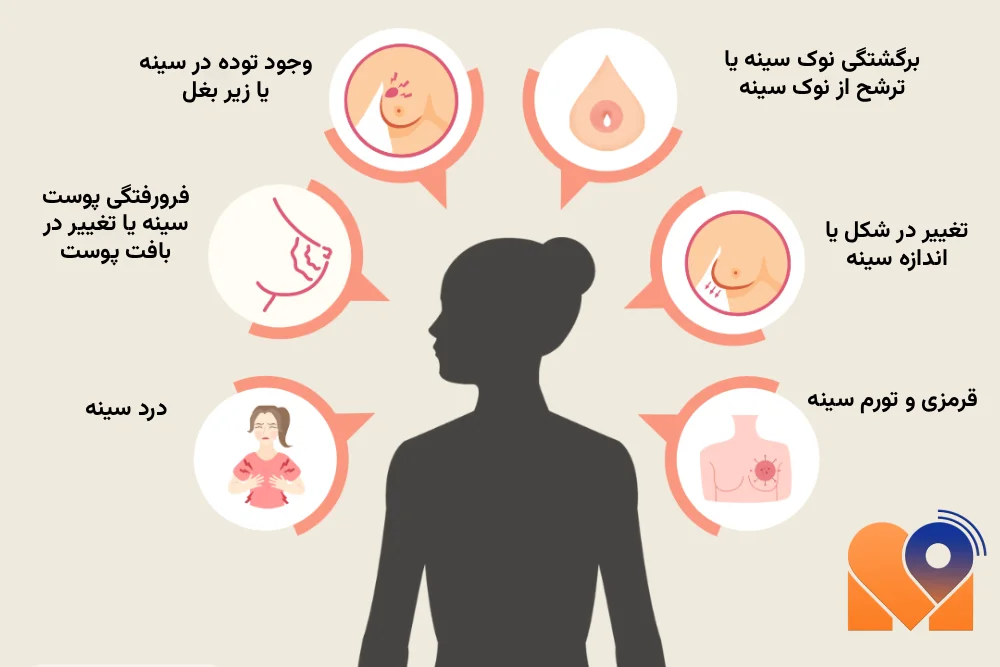 بهترین دکتر سرطان سینه