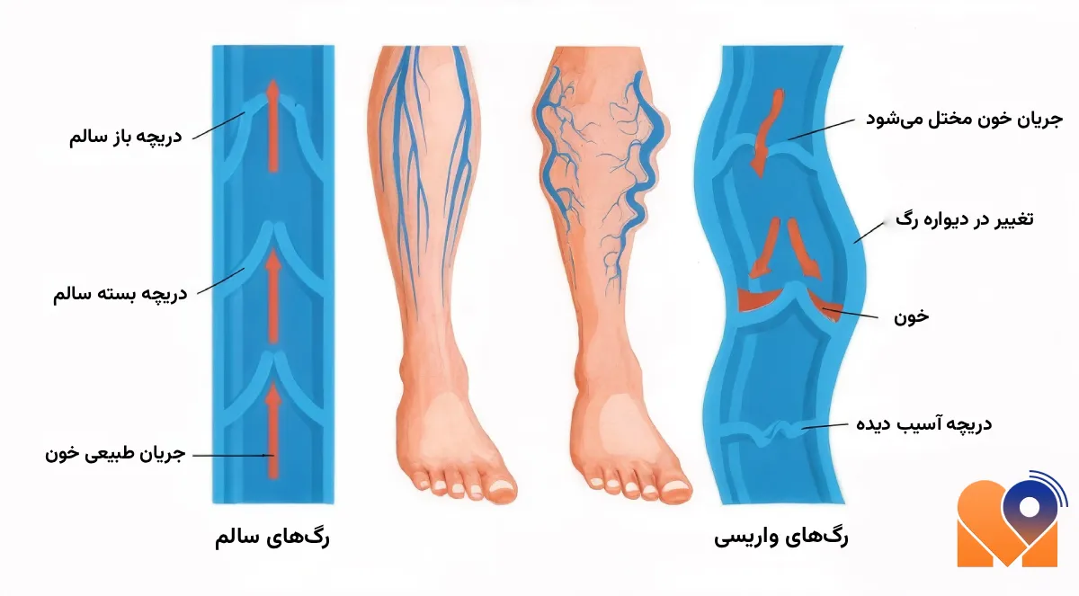 بهترین دکتر واریس