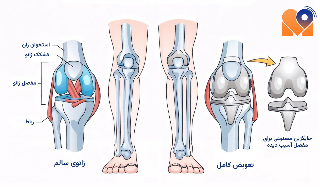 بهترین دکتر جراحی مفصل زانو