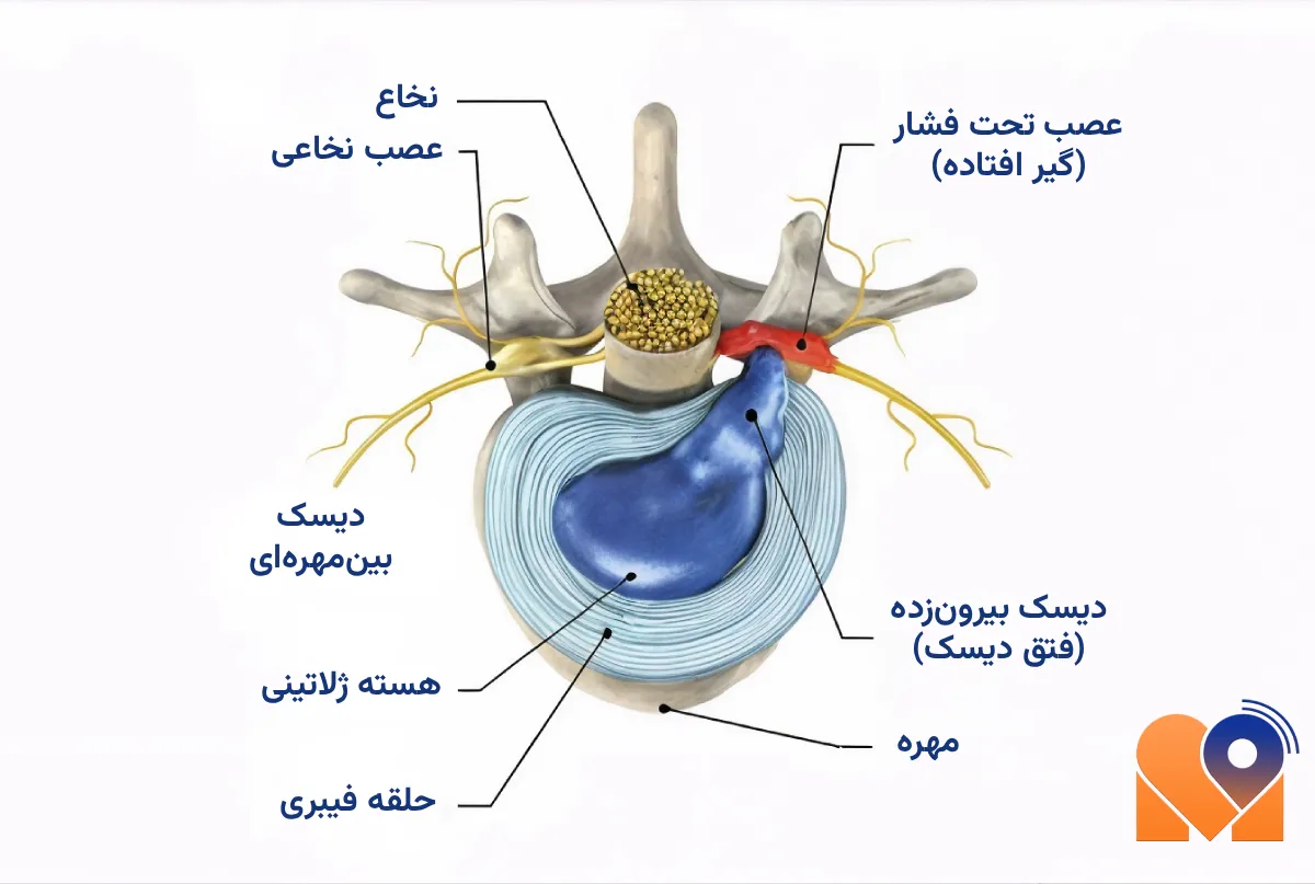 بهترین دکتر دیسک کمر