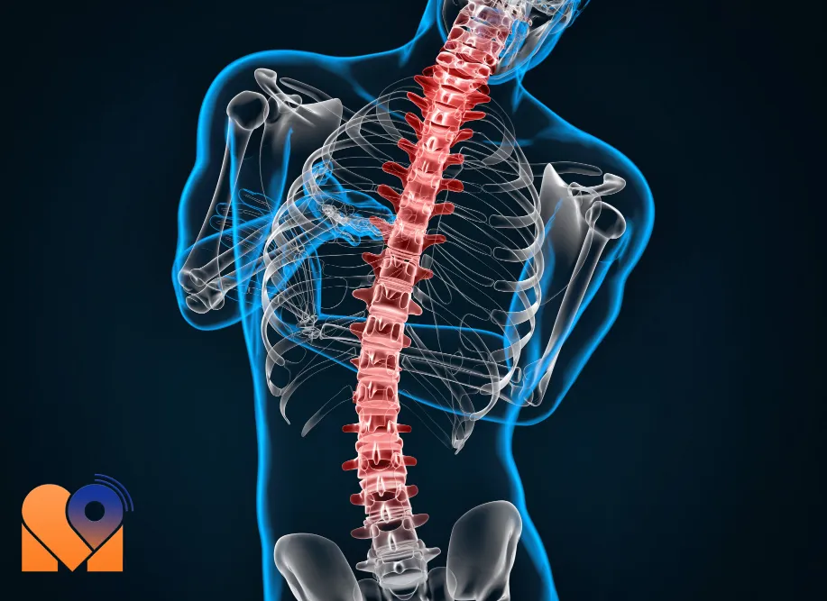 بهترین دکتر تنگی کانال نخاعی