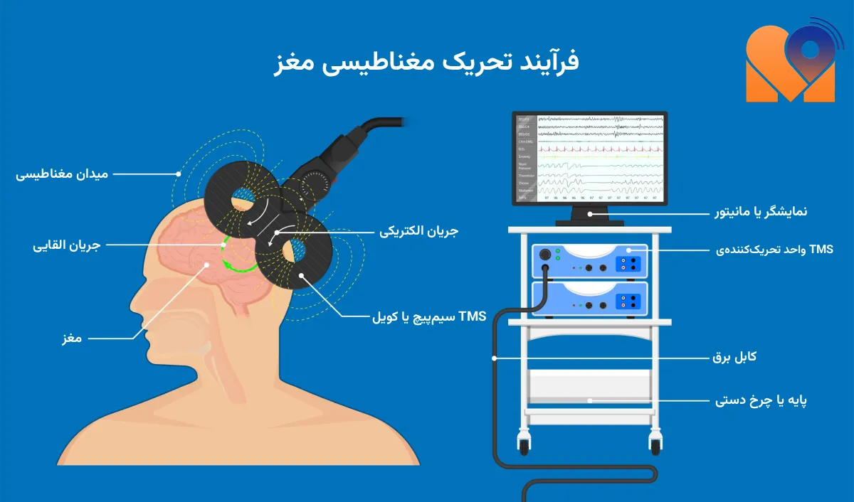 تحریک مغناطیسی تی ام اس