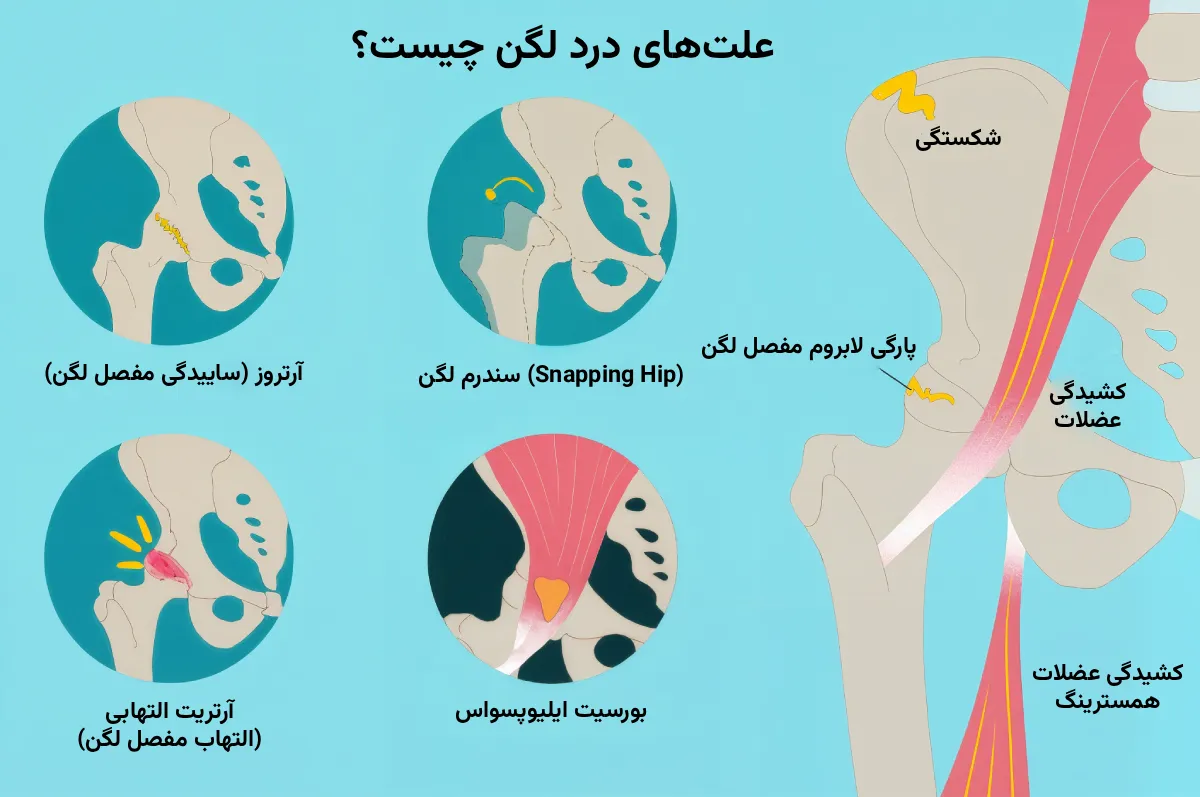 آسیب ها و مشکلات لگن