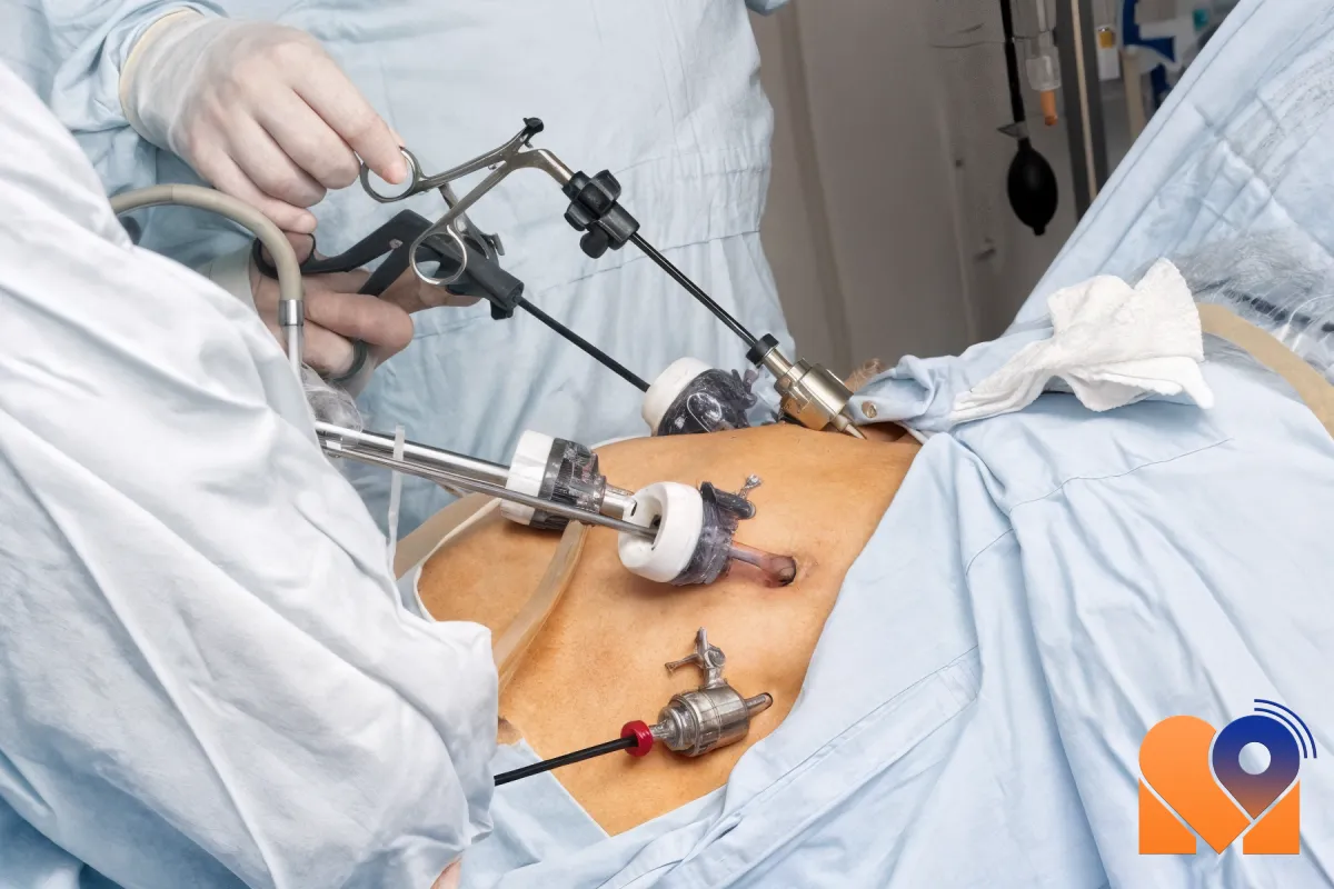 لاپاراسکوپی فیبروم رحم