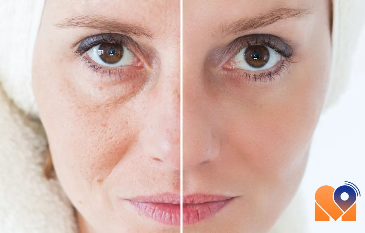 مهمترین ویژگیهای بهترین دکتر جوان سازی پوست