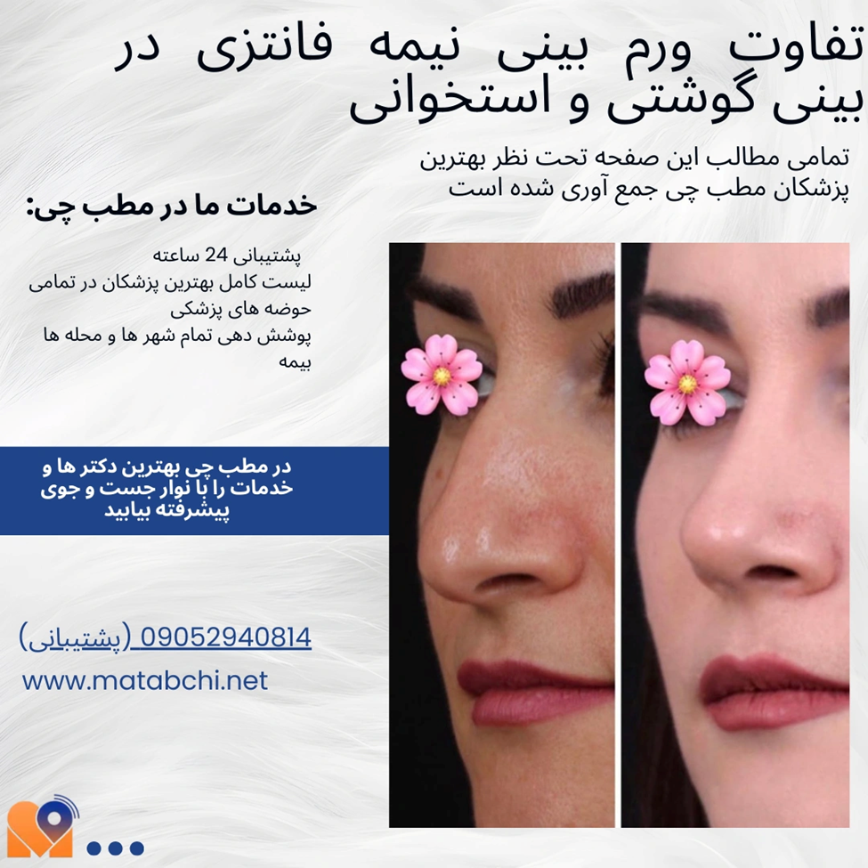 تفاوت ورم بینی نیمه فانتزی در بینی گوشتی و استخوانی