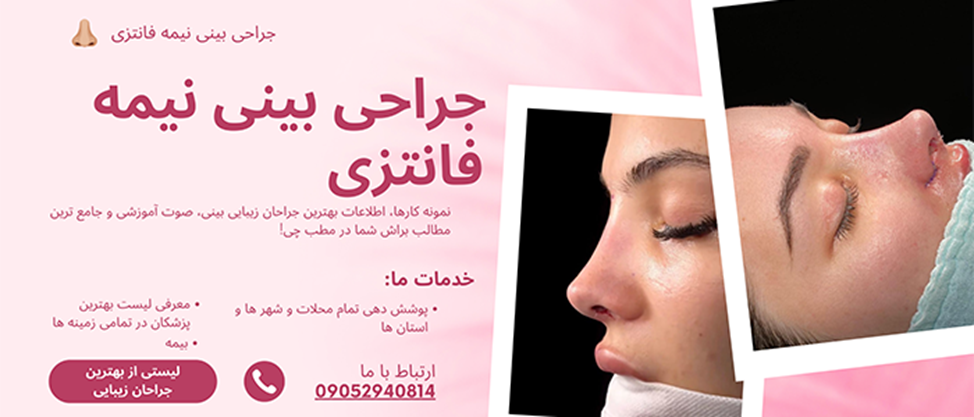 انتخاب دکتر مناسب در نتیجه جراحی بینی بسیار مهم است