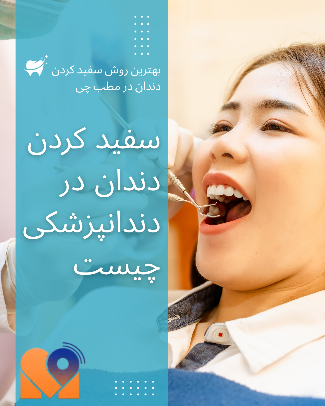 سفید کردن دندان در دندانپزشکی چیست