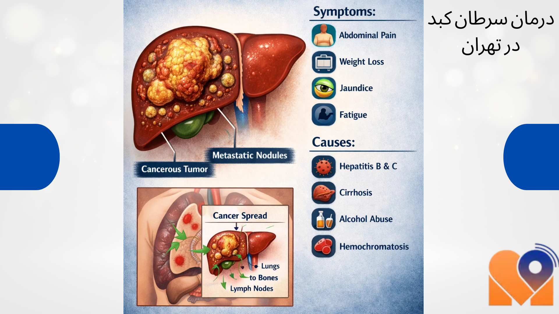 قدم به قدم درمان سطران کبد در پایخت با مطب چی