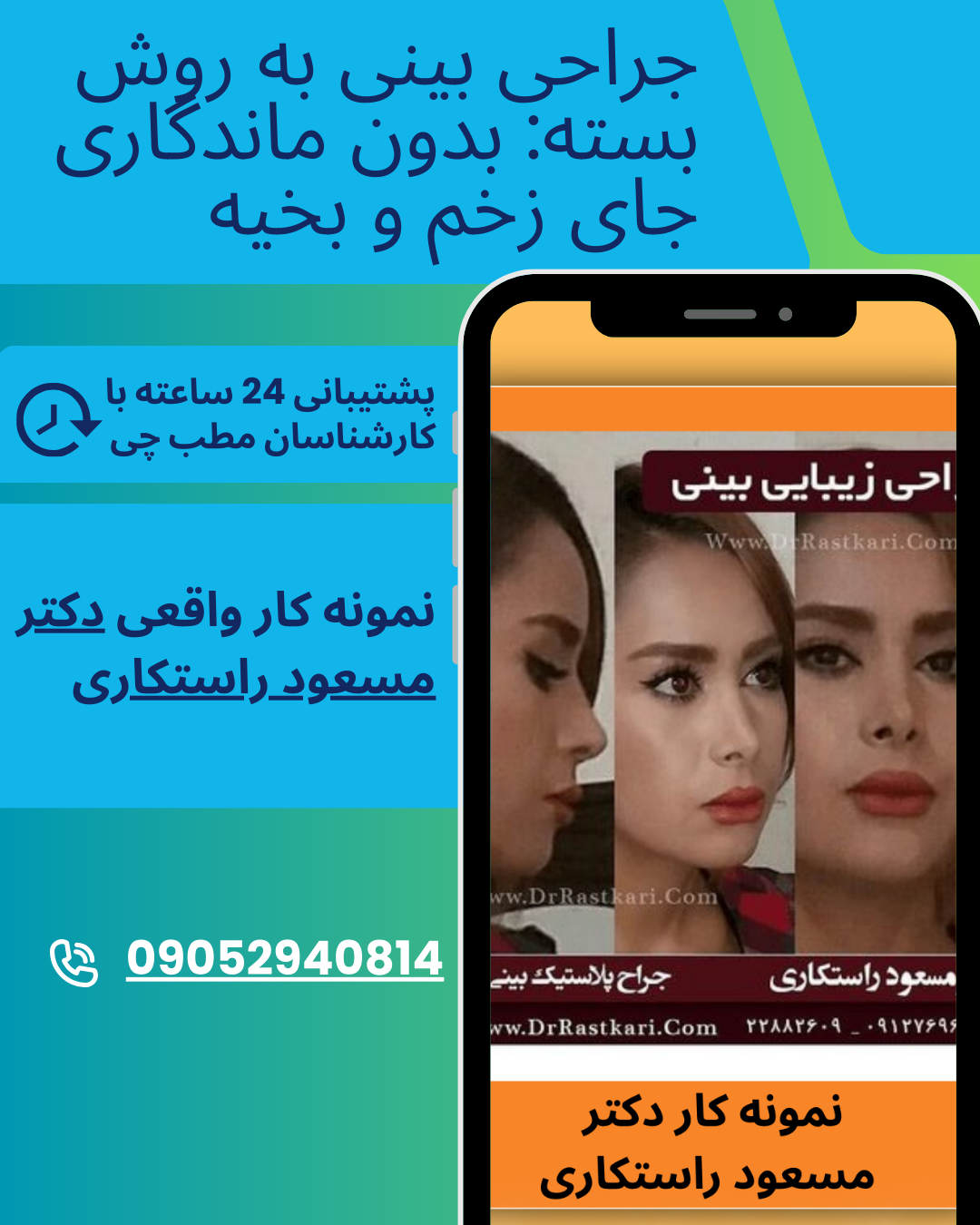 جراحی بینی به روش بسته با دکتر مسعود راستکاری 