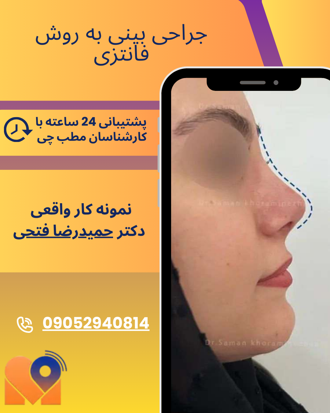 نمونه کار جراحی بینی فانتزی در تهران با دکتر حمیدرضا فتحی