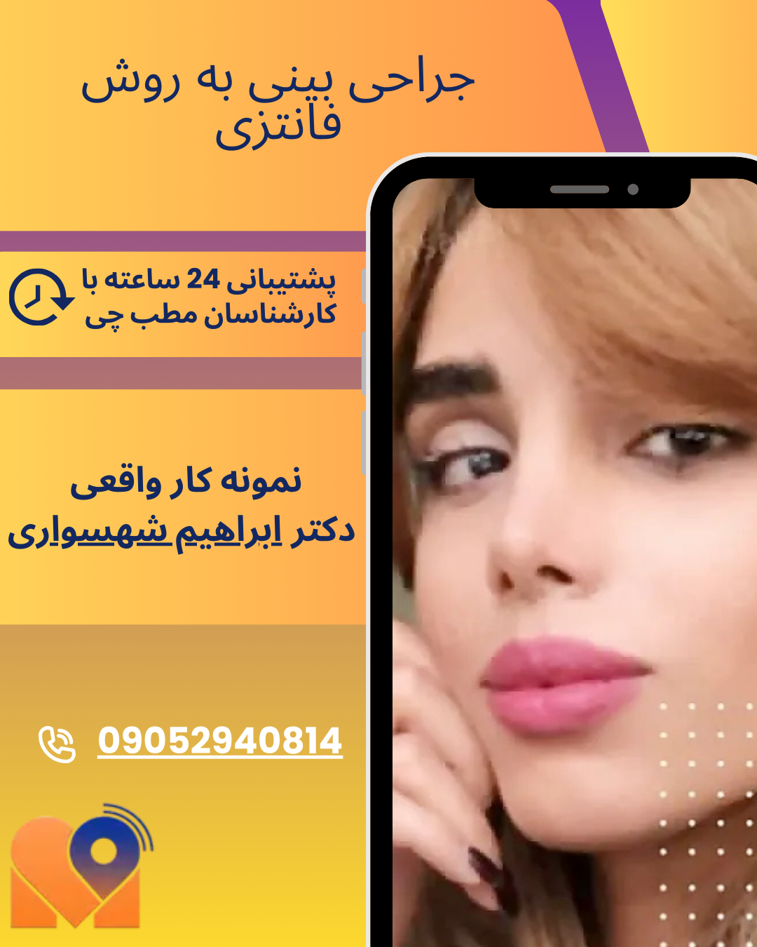 نمونه کار جراحی بینی فانتزی در تهران با دکتر ابراهیم شهسواری