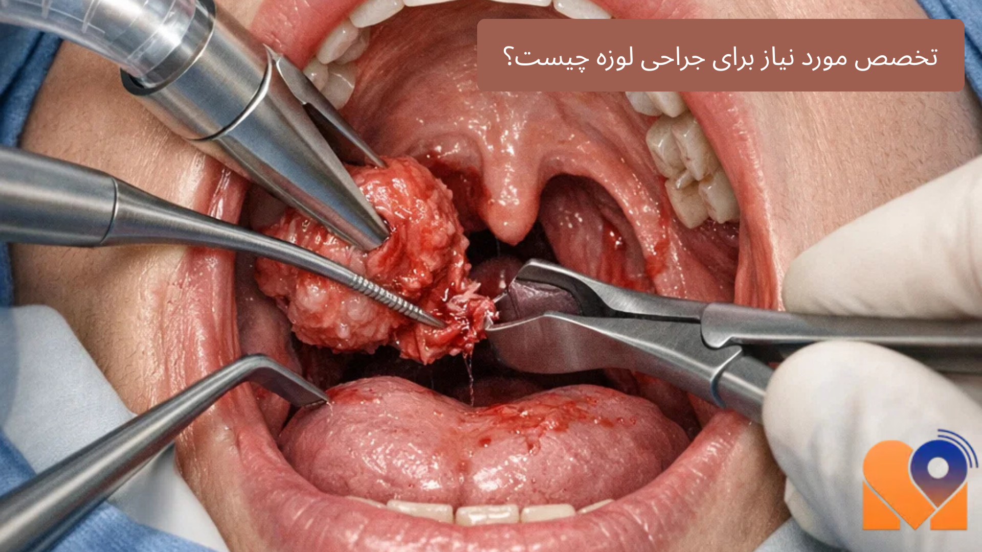 تخصص مورد نیاز برای جراحی لوزه چیست؟