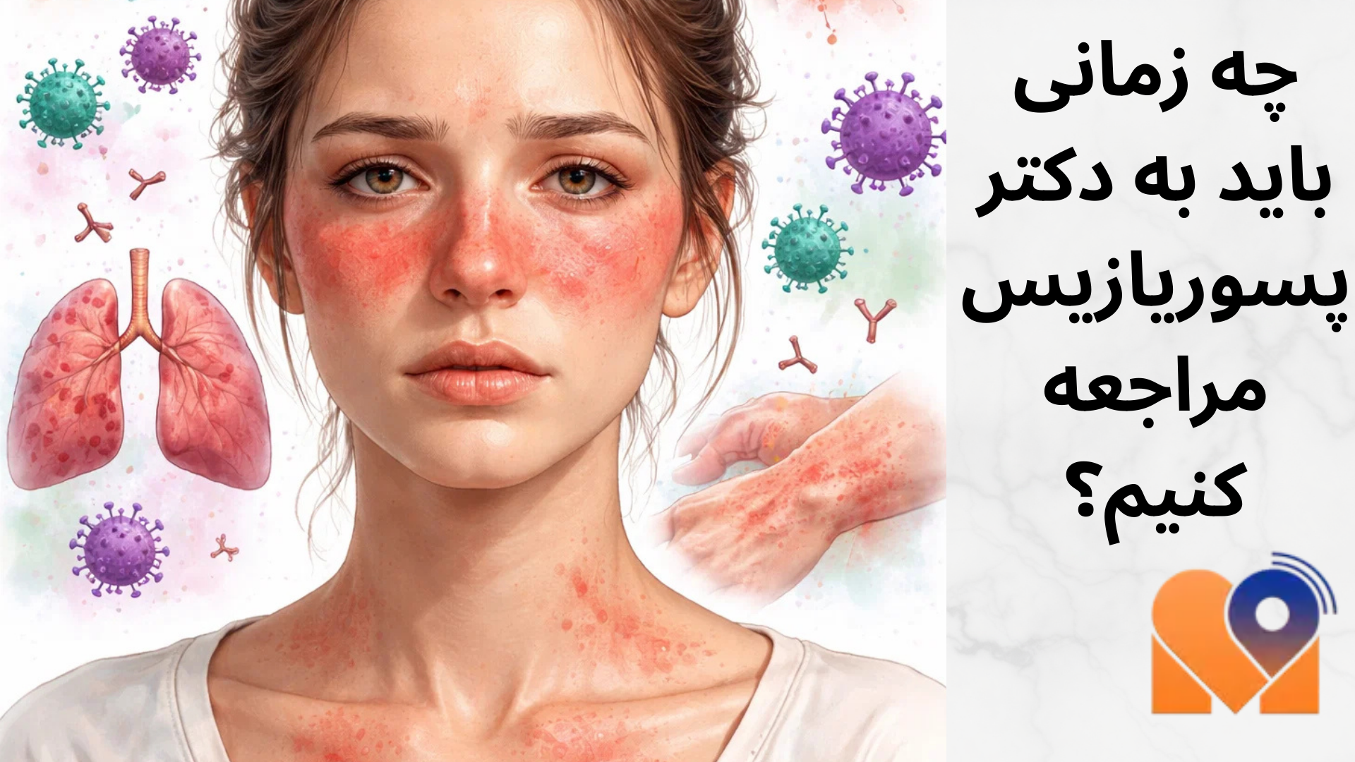 چه زمانی باید به دکتر پسوریازیس مراجعه کنیم؟