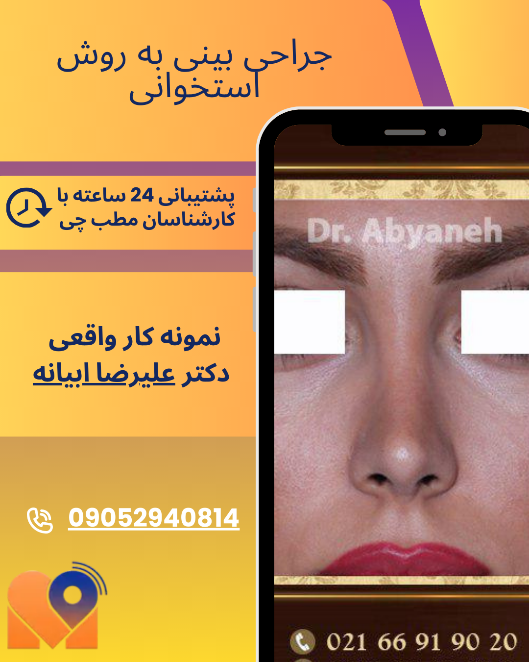 نمونه کارهای جراحان بینی در تهران