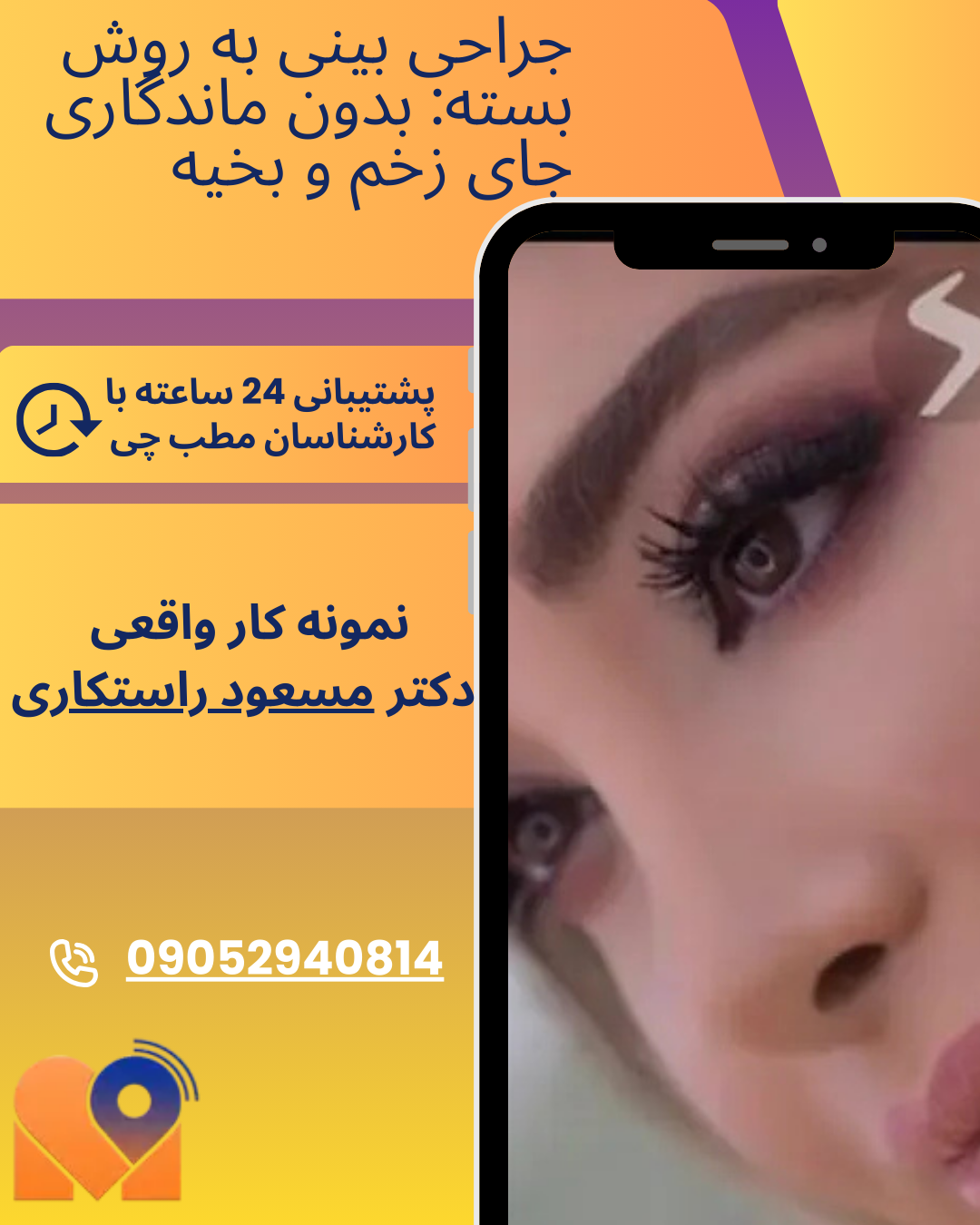 نمونه کارهای جراحان بینی در تهران