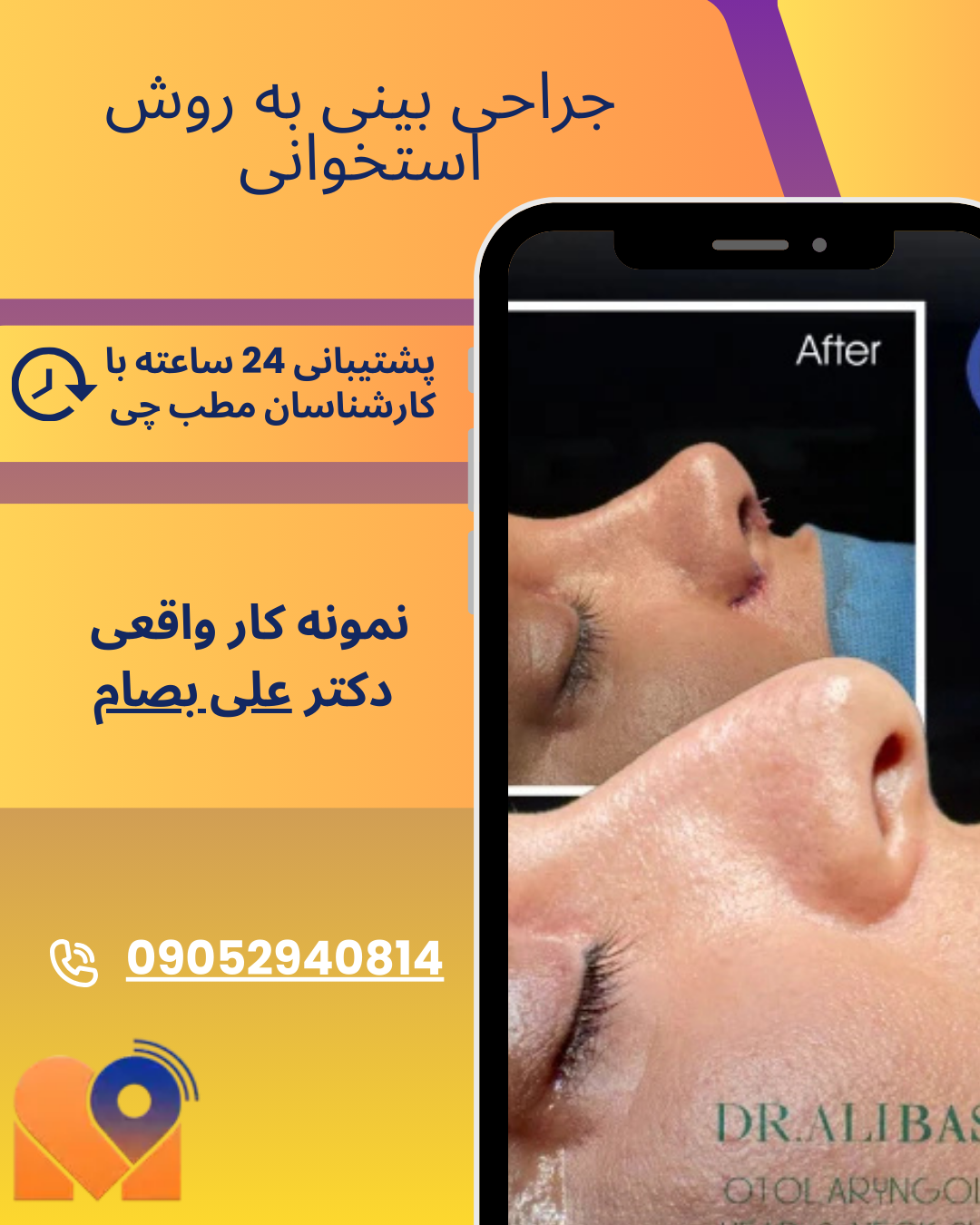 نمونه کارهای جراحان بینی در تهران