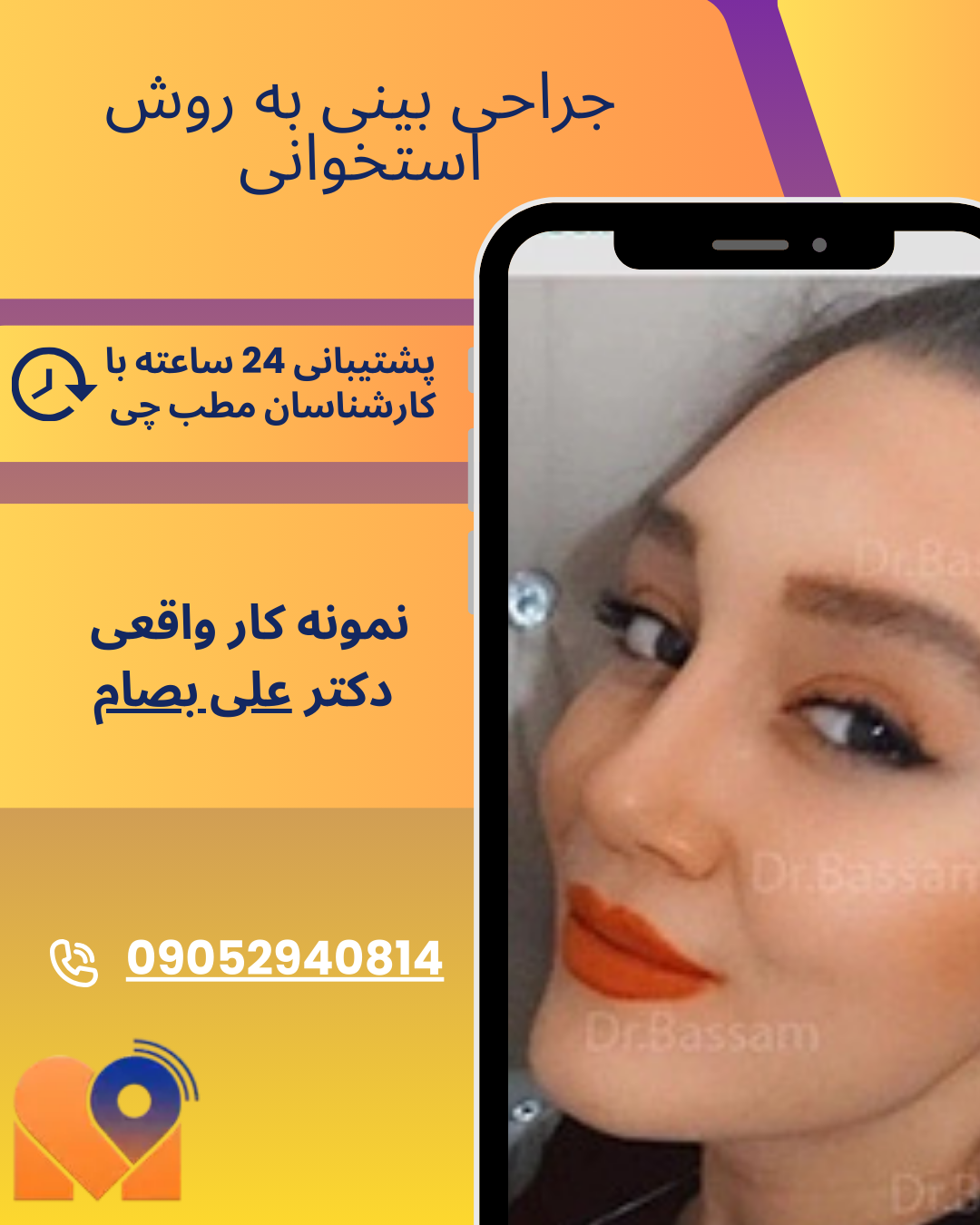 نمونه کارهای جراحان بینی در تهران