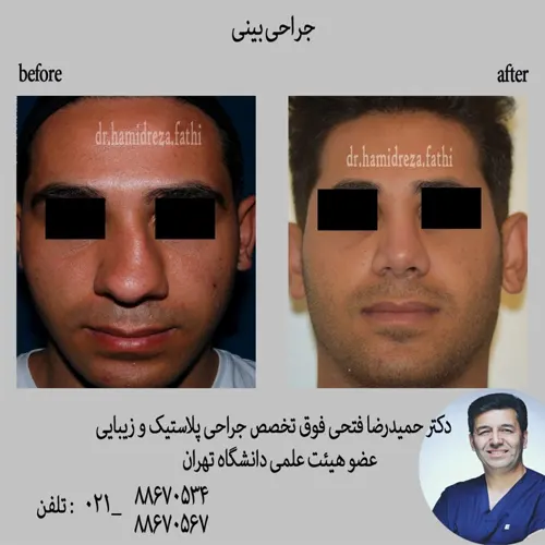 نمونه کارهای جراحان بینی در تهران