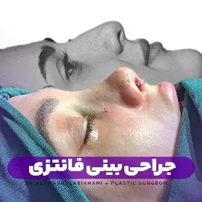 جراحی بینی فانتزی